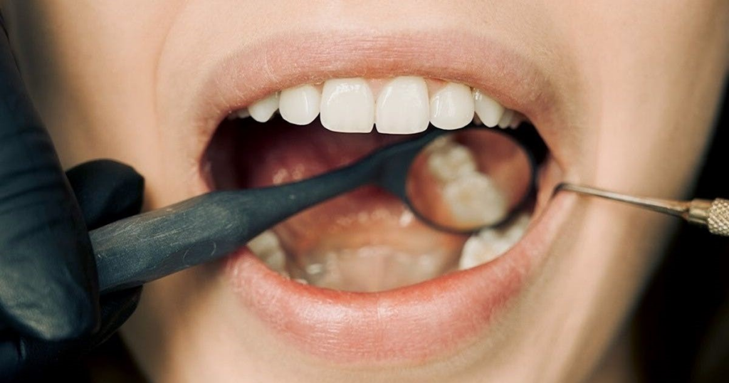 Oral cancer
