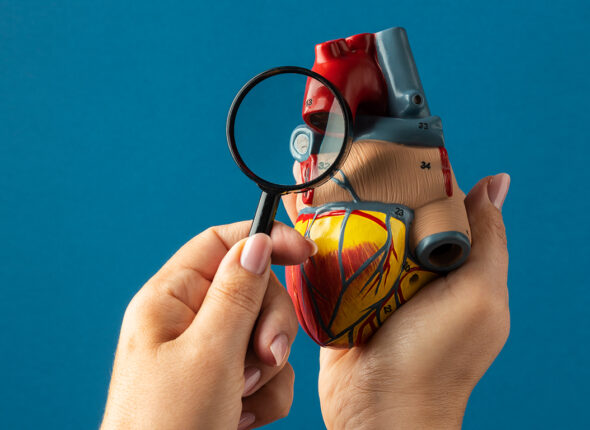 Congenital Heart Defect